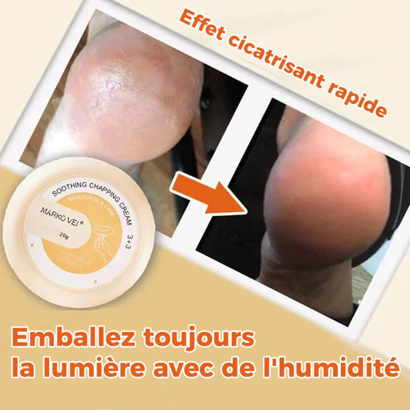 Ponceuse à Pied en Acier Inoxydable