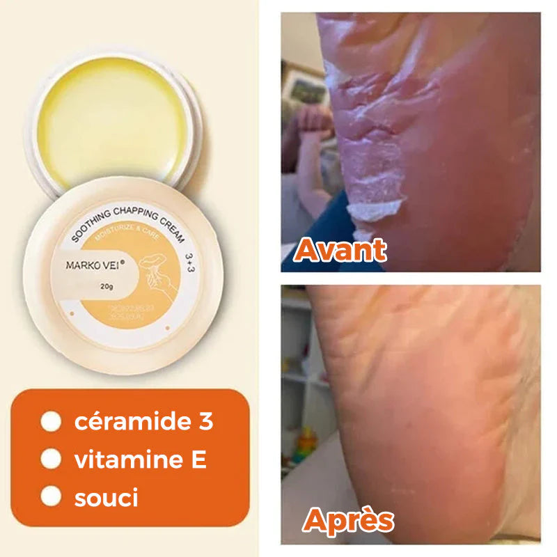 Ponceuse à Pied en Acier Inoxydable