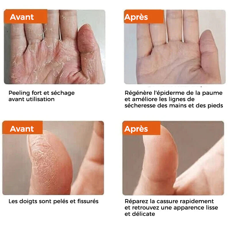 Ponceuse à Pied en Acier Inoxydable